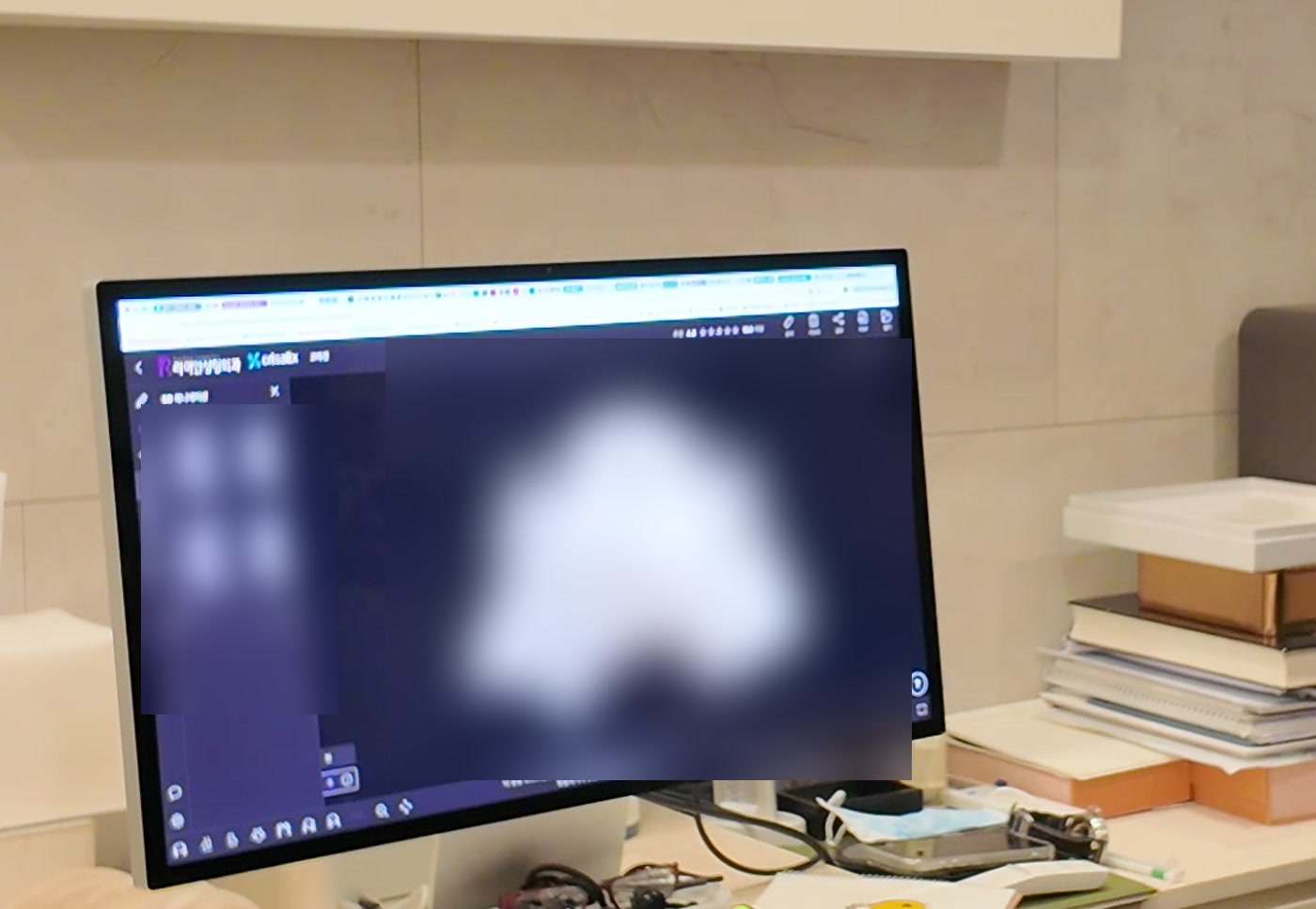 A 3D simulation tool used during consultation