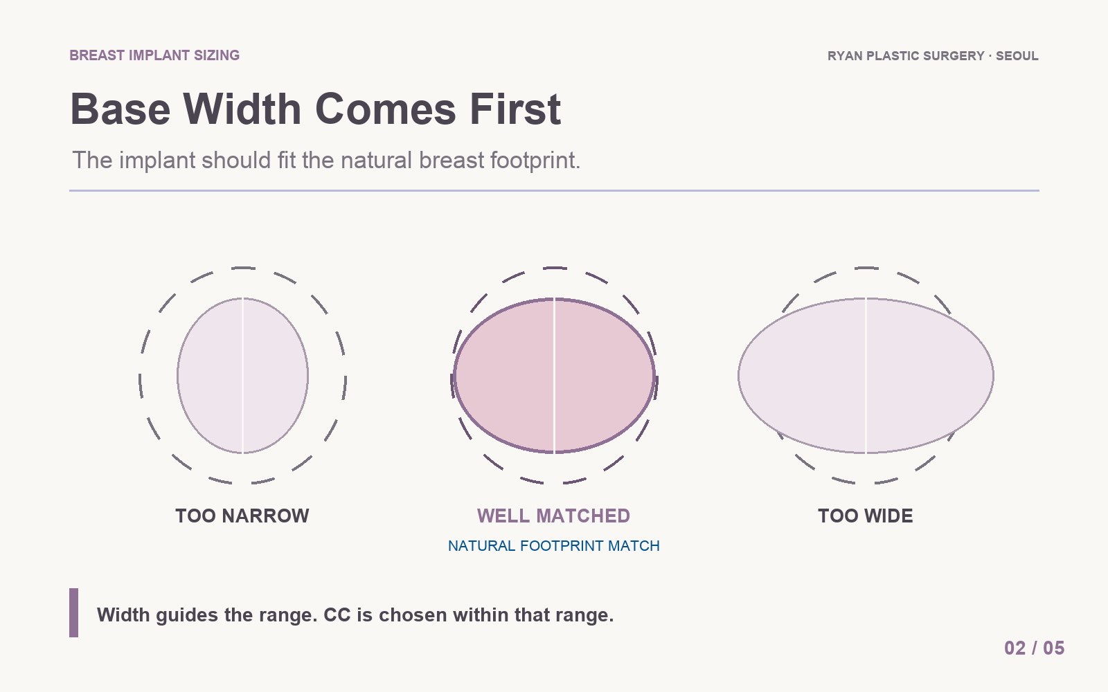 How breast base width guides implant selection